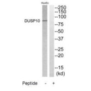 Western blot analysis of extracts from HuvEC cells, using DGKB antibody.