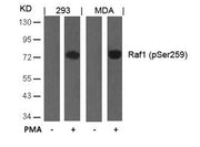 Western blot analysis of extracts from 293 and MDA cells untreated or treated with PMA using Raf1(Phospho-Ser259) Antibody.