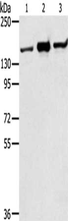Gel: 6%SDS-PAGE, Lysate: 40 ug, Lane 1-3: Jurkat cells, K562 cells, hela cells, Primary antibody: CSB-PA291248(STAG2 Antibody) at dilution 1/350, Secondary antibody: Goat anti rabbit IgG at 1/8000 dilution, Exposure time: 10 seconds