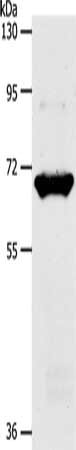 Gel: 10%SDS-PAGE, Lysate: 40 ug, Lane: Mouse liver tissue, Primary antibody: CSB-PA291254(SLC33A1 Antibody) at dilution 1/1100, Secondary antibody: Goat anti rabbit IgG at 1/8000 dilution, Exposure time: 1 minute