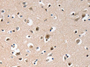 The image on the left is immunohistochemistry of paraffin-embedded Human brain tissue using CSB-PA291790(GCG(GLP1) Antibody) at dilution 1/20, on the right is treated with synthetic peptide. (Original magnification: ×200)