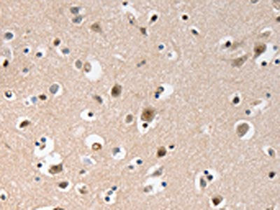 The image on the left is immunohistochemistry of paraffin-embedded Human brain tissue using CSB-PA291790(GCG(GLP1) Antibody) at dilution 1/20, on the right is treated with synthetic peptide. (Original magnification: ×200)