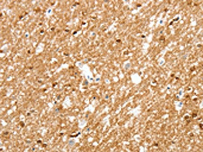 The image on the left is immunohistochemistry of paraffin-embedded Human brain tissue using CSB-PA292485(AMZ1 Antibody) at dilution 1/80, on the right is treated with synthetic peptide. (Original magnification: ×200)