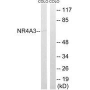 Western blot analysis of extracts from COLO cells, using NR4A3 antibody.