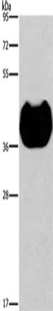 Gel: 8%SDS-PAGE, Lysate: 40 ug, Lane: Human fetal muscle tissue, Primary antibody: CSB-PA293019(HRH2 Antibody) at dilution 1/300, Secondary antibody: Goat anti rabbit IgG at 1/8000 dilution, Exposure time: 30 seconds