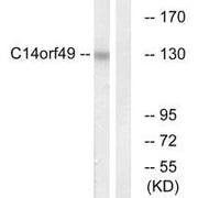 Western blot analysis of extracts from Jurkat cells, using C14orf49 antibody.