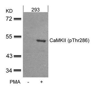 Western blot analysis of extracts from 293 cells untreated or treated with PMA using CaMKII(Phospho-Thr286) Antibody.