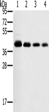 Gel: 10%SDS-PAGE, Lysate: 40 ug, Lane 1-4: 293T cells, A549 cells, hela cells, PC3 cells, Primary antibody: CSB-PA293886(PTGER1 Antibody) at dilution 1/200, Secondary antibody: Goat anti rabbit IgG at 1/8000 dilution, Exposure time: 10 seconds