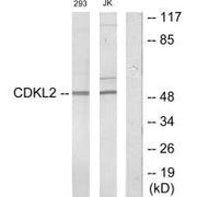 Western blot analysis of extracts from 293 cells and Jurkat cells, using CDKL2 antibody.