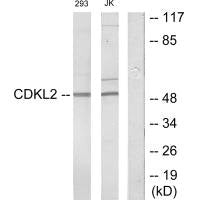 Western blot analysis of extracts from 293 cells and Jurkat cells, using CDKL2 antibody.
