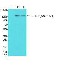 Western blot analysis of extracts from JK cells (Lane 2) and HuvEc cells (Lane 3), using EGFR (Ab-1071) antiobdy. The lane on the left is treated with synthesized peptide.
