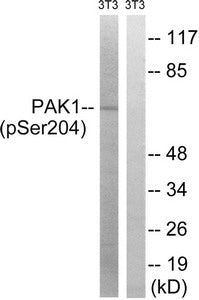 Western blot analysis of extracts from 3T3 cells treated with UV using PAK1 (Phospho-Ser204) Antibody.The lane on the right is treated with the antigen-specific peptide.