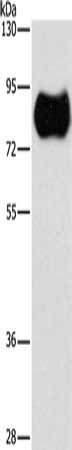 Gel: 8%SDS-PAGE, Lysate: 40 ug, Lane: Human fetal brain tissue, Primary antibody: CSB-PA294869(MAP4K2 Antibody) at dilution 1/900, Secondary antibody: Goat anti rabbit IgG at 1/8000 dilution, Exposure time: 30 seconds