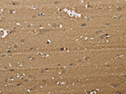 The image on the left is immunohistochemistry of paraffin-embedded Human brain tissue using CSB-PA295068(KDM5B Antibody) at dilution 1/40, on the right is treated with synthetic peptide. (Original magnification: ×200)