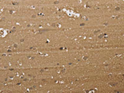 The image on the left is immunohistochemistry of paraffin-embedded Human brain tissue using CSB-PA295068(KDM5B Antibody) at dilution 1/40, on the right is treated with synthetic peptide. (Original magnification: ×200)