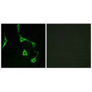 Immunofluorescence analysis of LOVO cells, using CDH10 antibody.