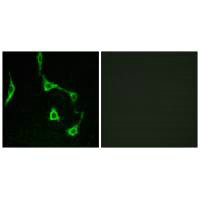 Immunofluorescence analysis of LOVO cells, using CDH10 antibody.