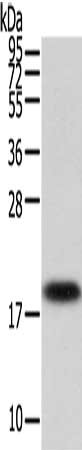 Gel: 12%SDS-PAGE, Lysate: 40 ug, Lane: Human fetal liver tissue, Primary antibody: CSB-PA295359(VPS25 Antibody) at dilution 1/200 dilution, Secondary antibody: Goat anti rabbit IgG at 1/8000 dilution, Exposure time: 30 seconds