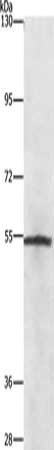 Gel: 8%SDS-PAGE, Lysate: 40 ug, Lane: Lovo cells, Primary antibody: CSB-PA295415(NEK2 Antibody) at dilution 1/727, Secondary antibody: Goat anti rabbit IgG at 1/8000 dilution, Exposure time: 1 minute