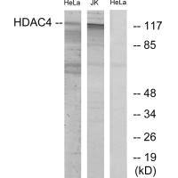 Western blot analysis of extracts from HeLa/Jurkat cells, using HDAC4 (Ab-632) antibody.