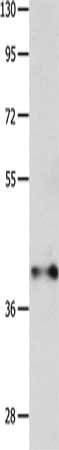 Gel: 10%SDS-PAGE, Lysate: 40 ug, Lane: Mouse muscle tissue, Primary antibody: CSB-PA295662(MADCAM1 Antibody) at dilution 1/300, Secondary antibody: Goat anti rabbit IgG at 1/8000 dilution, Exposure time: 1 minute