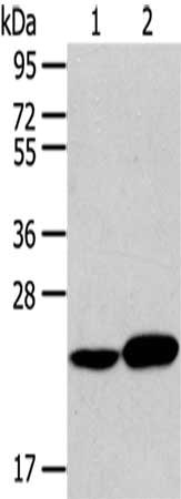 Gel: 10%SDS-PAGE,Lysate: 40ug,Lane 1-2: Human liver cancer tissue, Hela cells,Primary antibody: CSB-PA295669(RAB8A Antibody) at dilution 1/100 dilution,Secondary antibody: Goat anti rabbit IgG at 1/8000 dilution,Exposure time: 2 minutes