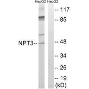 Western blot analysis of extracts from HepG2 cells, using SLC17A2 antibody.