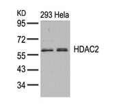 Western blot analysis of extracts from 293 and Hela cells using HDAC2(Ab-394) Antibody.