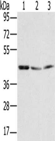 Gel: 8%SDS-PAGE, Lysate: 40 ug, Lane 1-3: K562 cells, hela cells, Jurkat cells, Primary antibody: CSB-PA296056(RBMX Antibody) at dilution 1/400, Secondary antibody: Goat anti rabbit IgG at 1/8000 dilution, Exposure time: 5 seconds