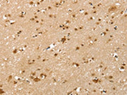 The image on the left is immunohistochemistry of paraffin-embedded Human brain tissue using CSB-PA296253(SLTM Antibody) at dilution 1/40, on the right is treated with synthetic peptide. (Original magnification: ×200)