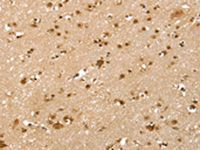 The image on the left is immunohistochemistry of paraffin-embedded Human brain tissue using CSB-PA296253(SLTM Antibody) at dilution 1/40, on the right is treated with synthetic peptide. (Original magnification: ×200)