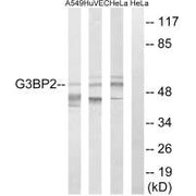 Western blot analysis of extracts from A549 cells, HUVEC cells and HeLa cells, using G3BP2 antibody.