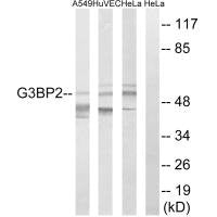 Western blot analysis of extracts from A549 cells, HUVEC cells and HeLa cells, using G3BP2 antibody.