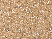 The image on the left is immunohistochemistry of paraffin-embedded Human brain tissue using CSB-PA296842(SDC3 Antibody) at dilution 1/45, on the right is treated with synthetic peptide. (Original magnification: ×200)