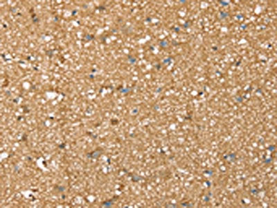 The image on the left is immunohistochemistry of paraffin-embedded Human brain tissue using CSB-PA296842(SDC3 Antibody) at dilution 1/45, on the right is treated with synthetic peptide. (Original magnification: ×200)