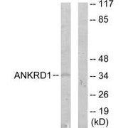 Western blot analysis of extracts from COLO205 cells, using ANKRD1 antibody.
