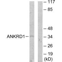 Western blot analysis of extracts from COLO205 cells, using ANKRD1 antibody.