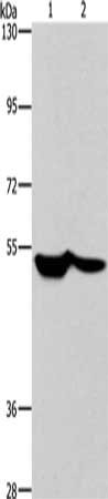 Gel: 6%SDS-PAGE, Lysate: 40 ug, Lane 1-2: 293T cells, PC3 cells, Primary antibody: CSB-PA297475(SCARB1 Antibody) at dilution 1/260, Secondary antibody: Goat anti rabbit IgG at 1/8000 dilution, Exposure time: 30 seconds
