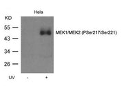 Western blot analysis of extracts from Hela cell untreated or treated with UV MEK1/MEK2(Phospho-Ser217/Ser221) Antibody