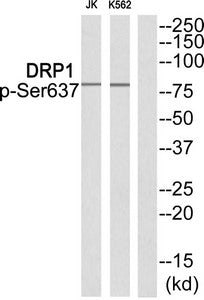 Western blot analysis of extracts from JK cells and K562 cells using DRP1 (Phospho-Ser637) Antibody.The lane on the right is treated with the antigen-specific peptide.