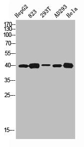 Western blot analysis of HEPG2 823 293T AD293 HELA using SR-1D antibody. Antibody was diluted at 1:500. Secondary antibody was diluted at 1:20000