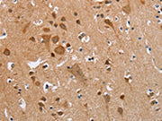 The image on the left is immunohistochemistry of paraffin-embedded Human brain tissue using CSB-PA297945(KRT13 Antibody) at dilution 1/35, on the right is treated with fusion protein. (Original magnification: ×200)