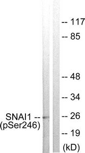 Western blot analysis of extracts from HT29 cells using SNAI1 (Phospho-Ser246) Antibody.The lane on the right is treated with the antigen-specific peptide.