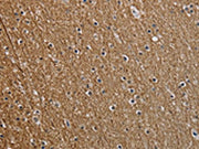 The image on the left is immunohistochemistry of paraffin-embedded Human brain tissue using CSB-PA298176(NEFM Antibody) at dilution 1/25, on the right is treated with synthetic peptide. (Original magnification: ×200)