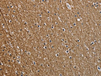 The image on the left is immunohistochemistry of paraffin-embedded Human brain tissue using CSB-PA298176(NEFM Antibody) at dilution 1/25, on the right is treated with synthetic peptide. (Original magnification: ×200)