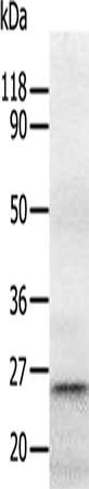 Gel: 10%SDS-PAGE, Lysate: 30 ug, Lane: Human fetal brain tissue, Primary antibody: CSB-PA298327(RAB5A Antibody) at dilution 1/1300, Secondary antibody: Goat anti rabbit IgG at 1/8000 dilution, Exposure time: 1 minute