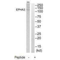 Western blot analysis of extracts from 293 cells, using EPHA3 antibody.