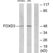 Western blot analysis of extracts from HUVEC cells and 293 cells, using FOXD3 antibody.