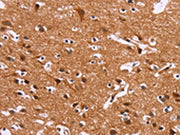The image on the left is immunohistochemistry of paraffin-embedded Human brain tissue using CSB-PA298832(IRAK1BP1 Antibody) at dilution 1/30, on the right is treated with fusion protein. (Original magnification: ×200)