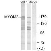 Western blot analysis of extracts from COS-7 cells and HT-29 cells, using MYOM2 antibody.